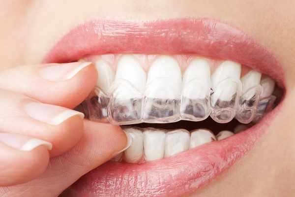 invisalign-dentist-astoria